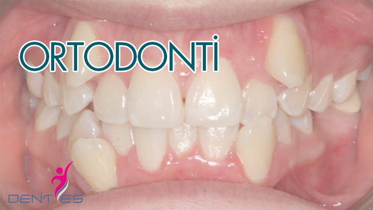 ortodonti-1
