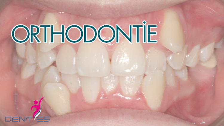 ortodonti-fr-1