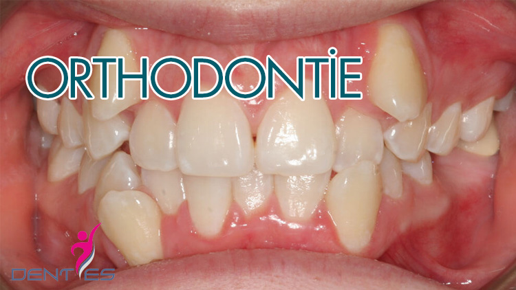 ortodonti-fr-2