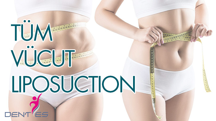 tum-vucut-liposuction-1
