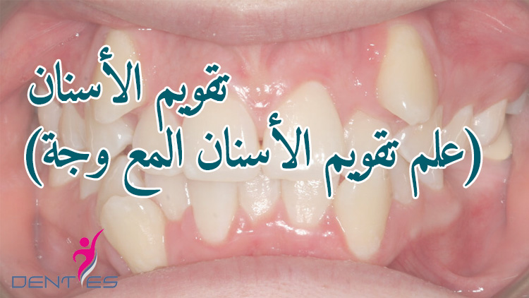 ortodonti-ar-1