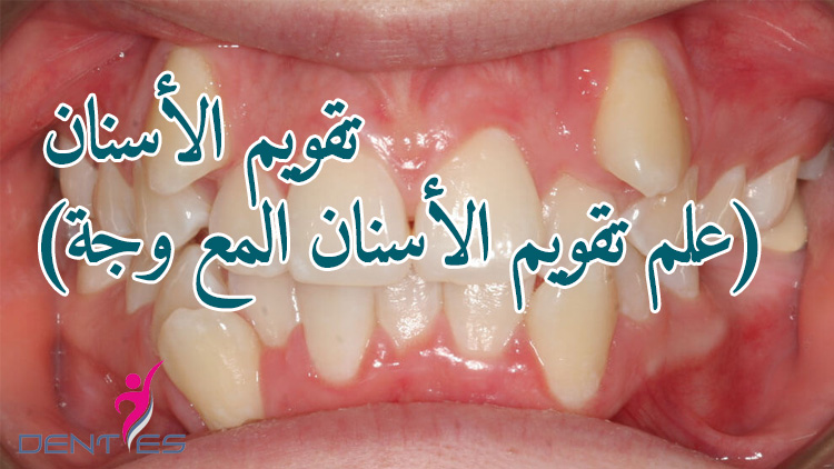 ortodonti-ar-2