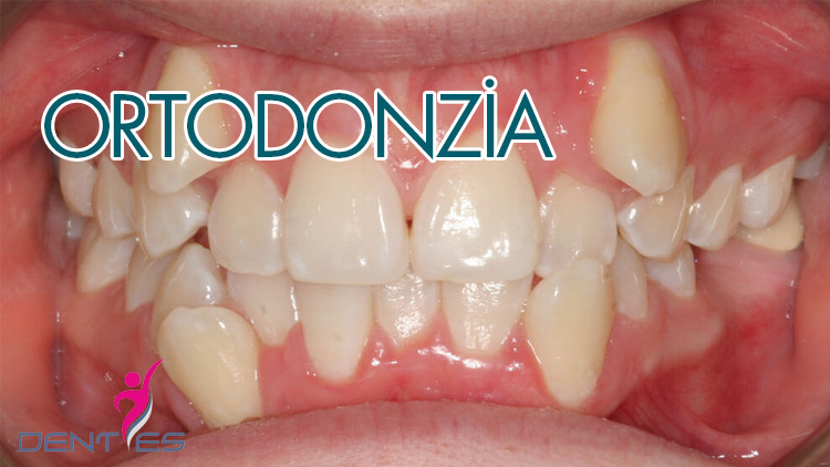 ortodonti-it-2